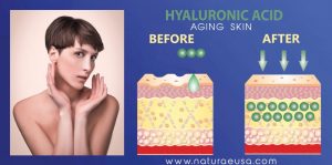 Aging-Skin-Hyaluronic Acid